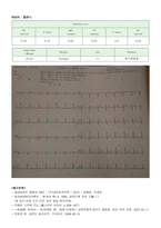 심전도(EKG) 측정 보고서-3