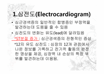 심근경색증 진단방법과 심전도-4