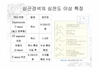 심근경색증 진단방법과 심전도-7