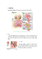 [간호학] 만성 폐쇄성 폐질환(COPD)-만성 기관지염 CASE STUDY-3