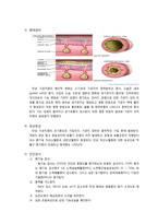 [간호학] 만성 폐쇄성 폐질환(COPD)-만성 기관지염 CASE STUDY-4