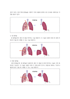 [간호학] 비소세포성 폐암의 병태생리 및 사례연구-11