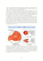 [간호학] 위절제술 간호 PBL-9