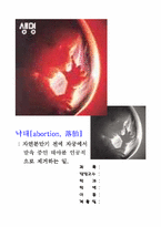 낙태문제 레포트-1