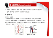 뇌경색(Cerebral Infarction) 병태생리-8