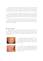 [청소년고민]여드름에 개념과 사춘기 시절의 여드름 치료 방법-3