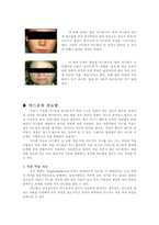 [청소년고민]여드름에 개념과 사춘기 시절의 여드름 치료 방법-4