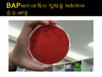 미생물 실습 미생물 검사 목적 미생물 검체 도착 균 배양 균의 특이 집락 채취-8