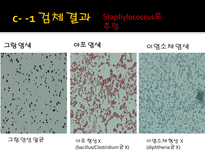 미생물 실습 미생물 검사 목적 미생물 검체 도착 균 배양 균의 특이 집락 채취-20