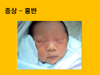 자연과학 아토피 자연의 역습 재앙으로 돌아온 환경성질환-16