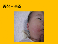 자연과학 아토피 자연의 역습 재앙으로 돌아온 환경성질환-17