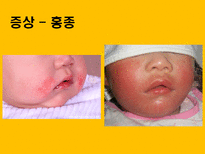 자연과학 아토피 자연의 역습 재앙으로 돌아온 환경성질환-18