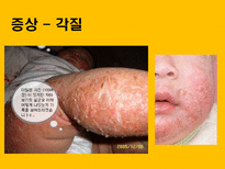자연과학 아토피 자연의 역습 재앙으로 돌아온 환경성질환-19