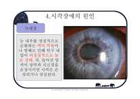 사회과학 시각장애인의 심리-19