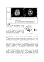 동서협진과 CASE 안면마비를 보인 뇌출혈 환자 1례-2