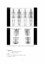 침구과학 교통사고로 인한 Lt chest pain 과 multiple contusion을 호소하는 환자-5