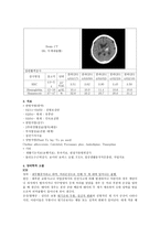 동서협진과 CASE 감정기복이 심한 ICH Osteoporosis 여환 1례-2