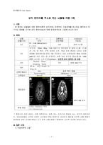 동서협진과 CASE 상지 편마비를 주소로 하는 뇌출혈 여환 1례-1