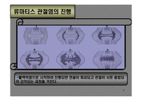 의약학 관절염-6