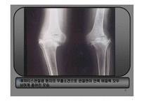 의약학 관절염-8