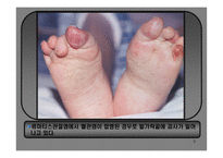 의약학 관절염-9