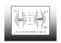 의약학 관절염-14