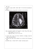 진단 방사선과 PK 레포트 MRI MRI 역사 MRI 개요 MRI 물리적 원리 MRI 시스템-13