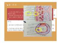 호흡기 기능장애 아동간호 - 크룹증후군, 하부기도감염-13