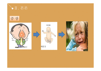 호흡기 기능장애 아동간호 - 크룹증후군, 하부기도감염-14