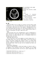 동서협진과 CASE 인공호흡기를 사용하고 있는 수두증 환자 1례-2