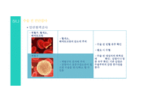 수술 전 간호(진단, 교육-통증관리, 신체활동, 심호흡, 기침, 다리운동)-4