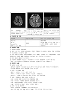 동서협진과 CASE 뇌경색 후의 우측 무력증으로 내원한 남환 1례-2