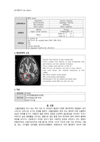 동서협진과 CASE 객담 호흡곤란을 호소하는 뇌경색 남환 1례-2