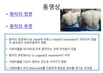 글로리병원 성인 CASE STUDY-8