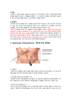 간호진단 일반외과 담낭담관 결석증 케이스 acalculous cholecystitis with cystic duct stone-15