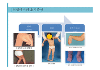 특수교육학개론 지체장애-9