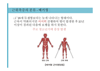 특수교육학개론 지체장애-15