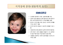 지적장애(Intellectual Disability) - 정의, 인구현황, 원인, 진단과 분류, 종류-14