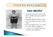 지적장애(Intellectual Disability) - 정의, 인구현황, 원인, 진단과 분류, 종류-16