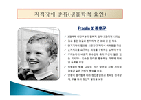 지적장애(Intellectual Disability) - 정의, 인구현황, 원인, 진단과 분류, 종류-20