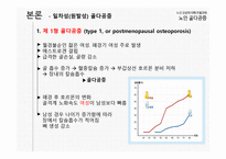 노인 건강의 이해 - 노인 골다공증-15
