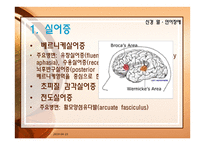 신경 말 언어장애 - 실어증 운동말장애-4