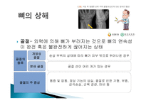 스포츠활동에서의 처치-8