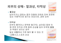 스포츠활동에서의 처치-10