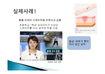스포츠활동에서의 처치-11