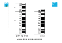 묘성 증후군과 윌리엄스 증후군-7