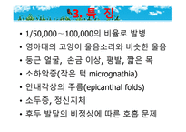 묘성 증후군과 윌리엄스 증후군-8