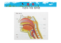 묘성 증후군과 윌리엄스 증후군-11
