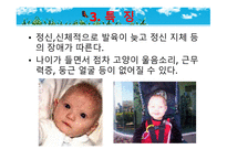 묘성 증후군과 윌리엄스 증후군-15