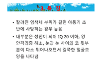 묘성 증후군과 윌리엄스 증후군-16